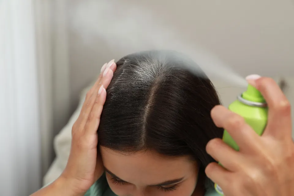 Does Dry Shampoo Cause Hair Loss