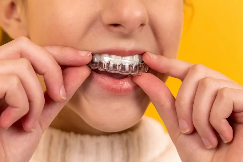 Love Your Teeth Reviews 2023 - Is It Effective Teeth Whitening Method?