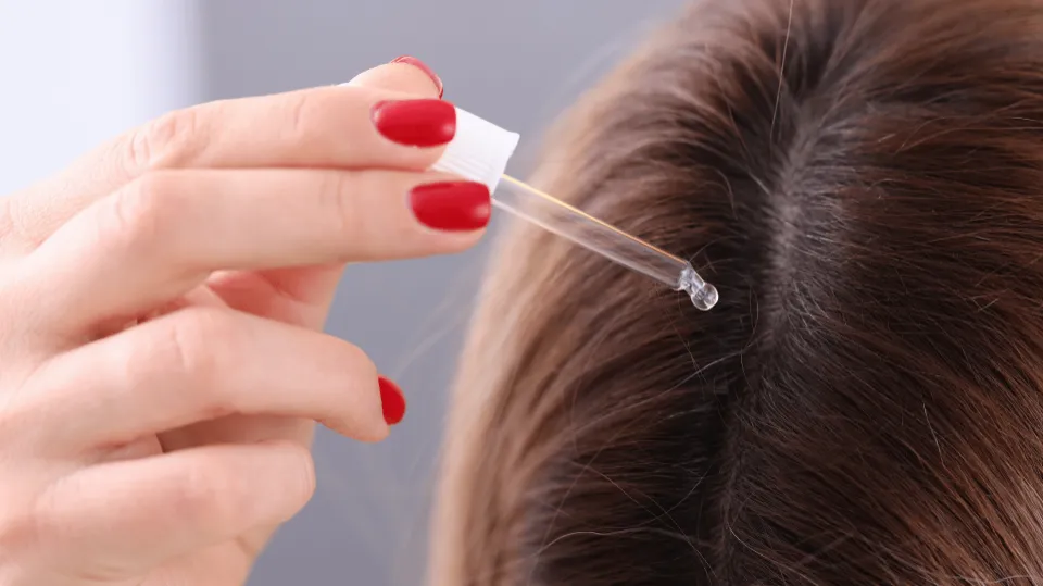 Can Minoxidil Cause Hair Loss
