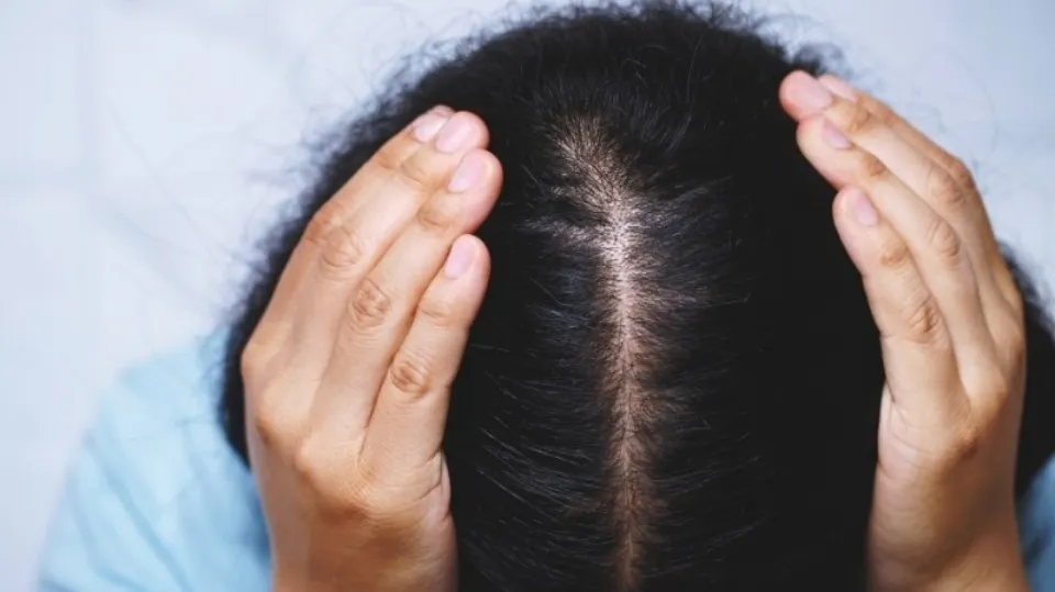Does Gabapentin Cause Hair Loss